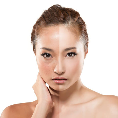 NIACINAMIDE FACE WHITENING CREAM (60G)